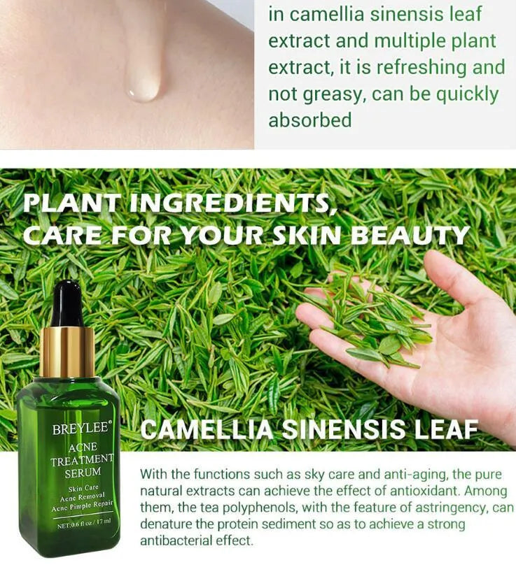 Acne treatment serum facial repair oil with Camellia sinensis leaf extract liquid formulation