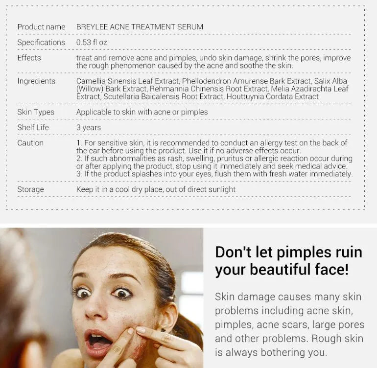 Acne treatment serum facial repair oil with Camellia sinensis leaf extract liquid formulation