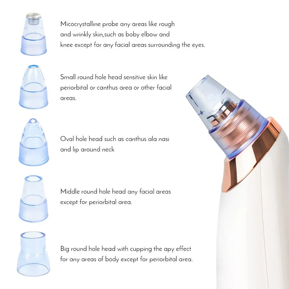 Electric blackhead remover vacuum pore cleaner with black nozzle, compact 18 cm handheld device