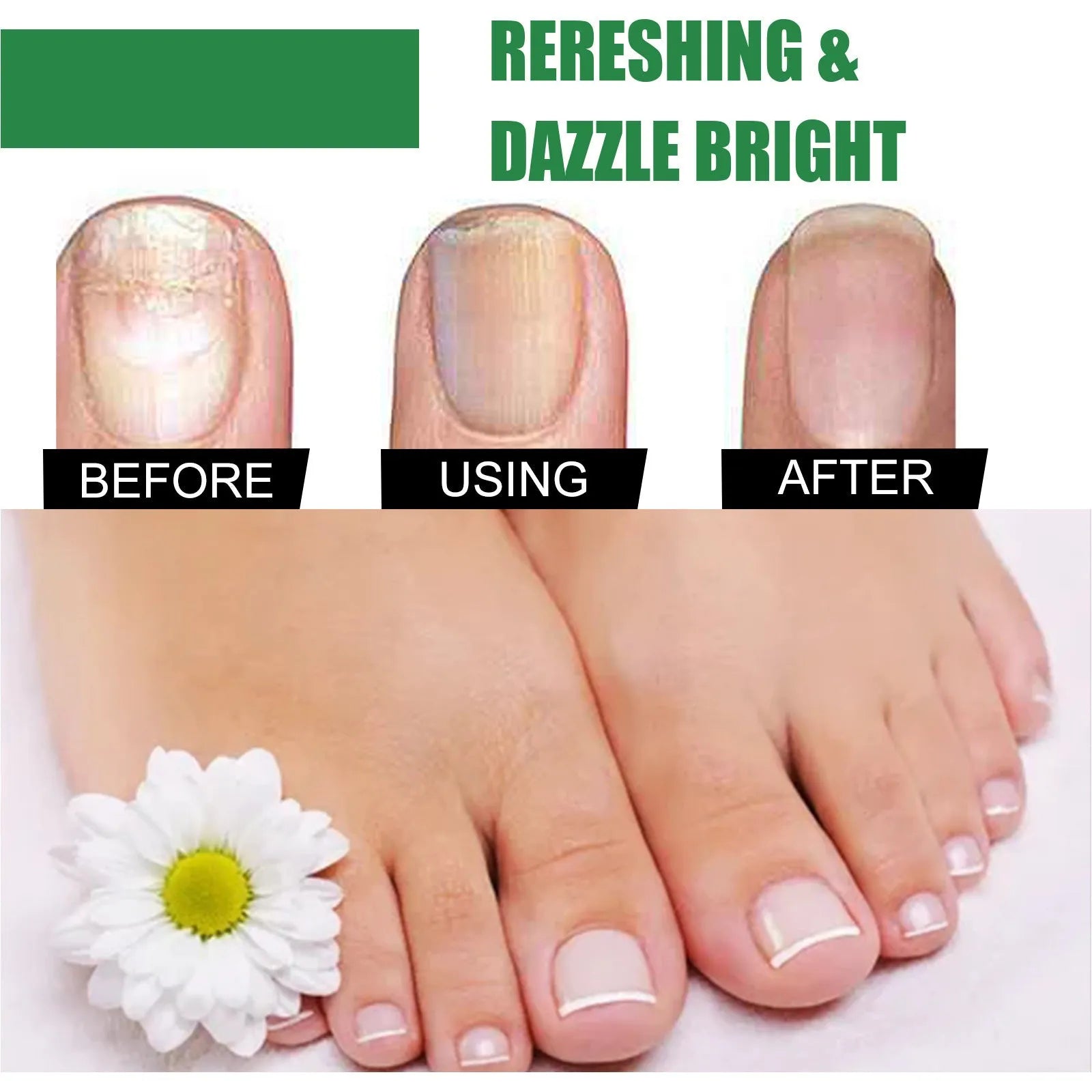 30ml bottle of tea tree oil nail repair liquid for thickened fingernails and toenails