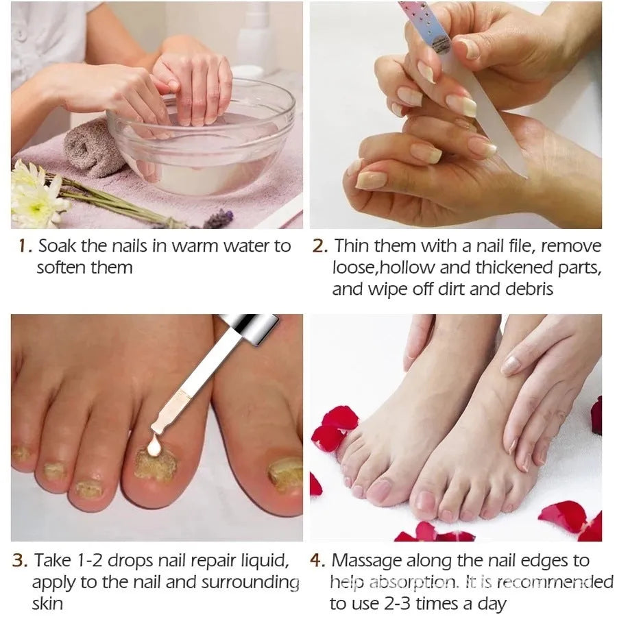 Jiagou Whitenail Antibacterial Liquid 10ml bottle for foot and toenail care