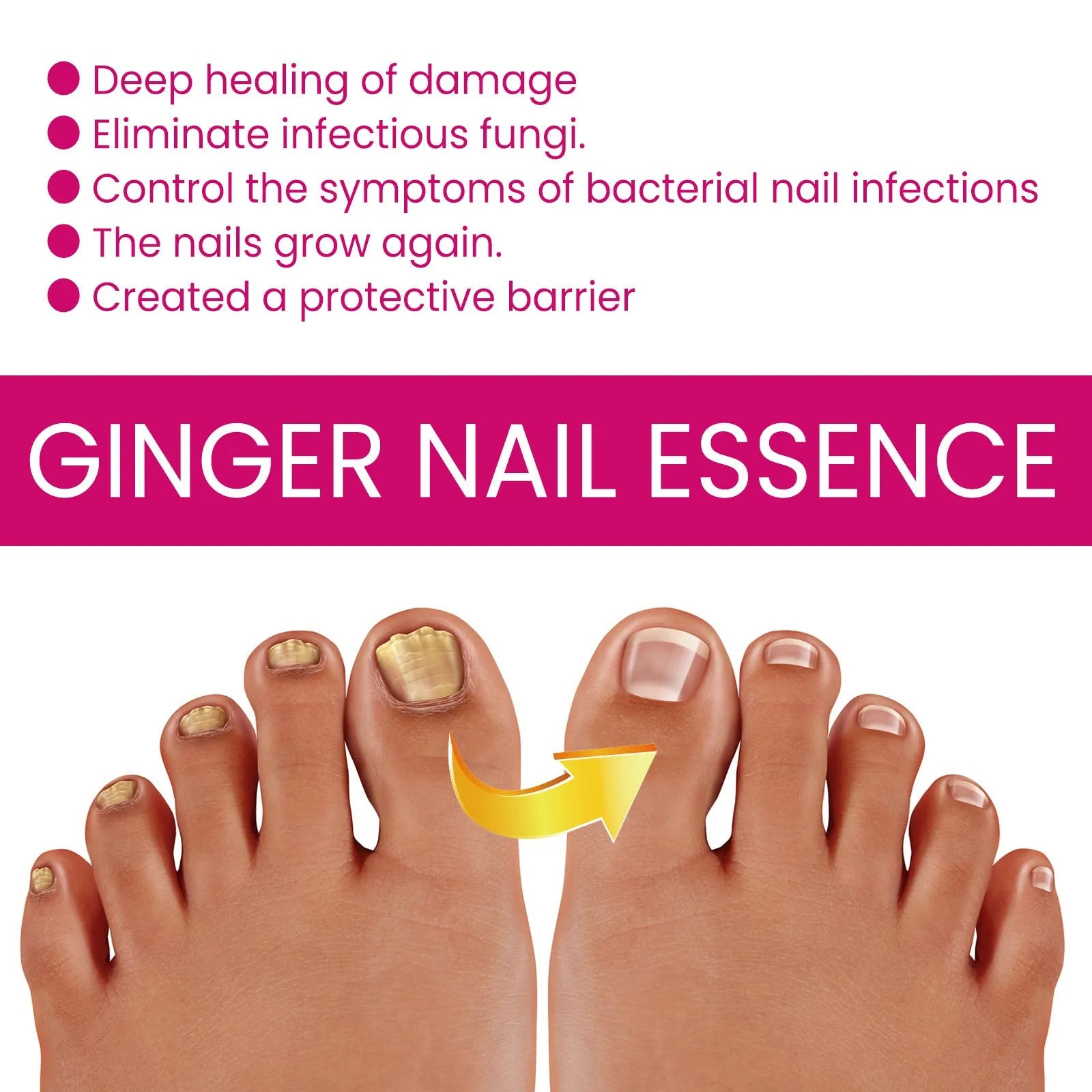Ginger nail care essence 10ml bottle with dropper, showcasing clear liquid formula