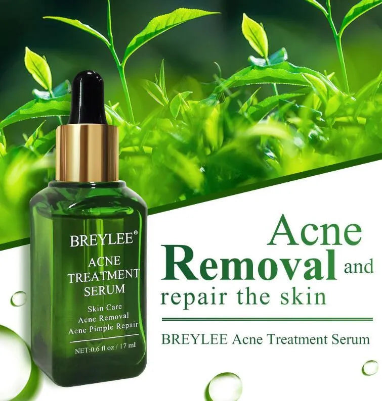 Acne treatment serum facial repair oil with Camellia sinensis leaf extract liquid formulation