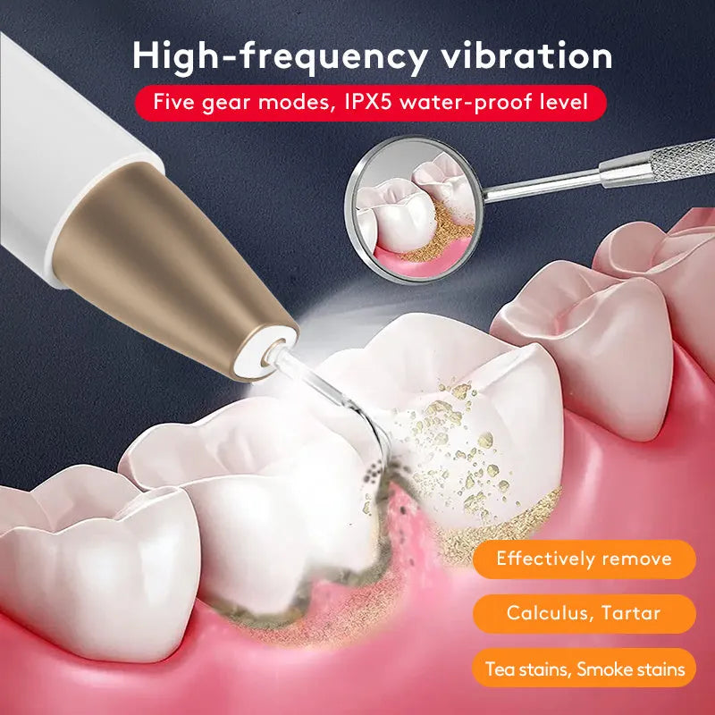 Gold ultrasonic tooth cleaning device for removing stains and tartar at home