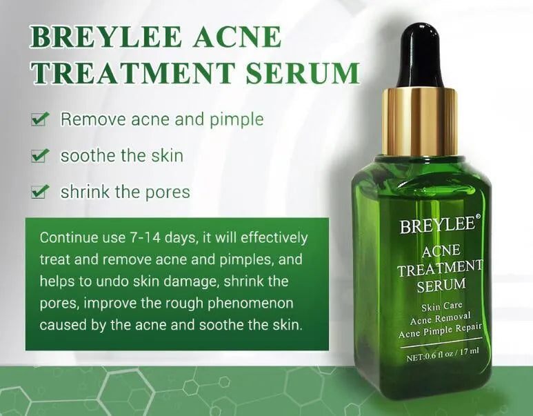 Acne treatment serum facial repair oil with Camellia sinensis leaf extract liquid formulation
