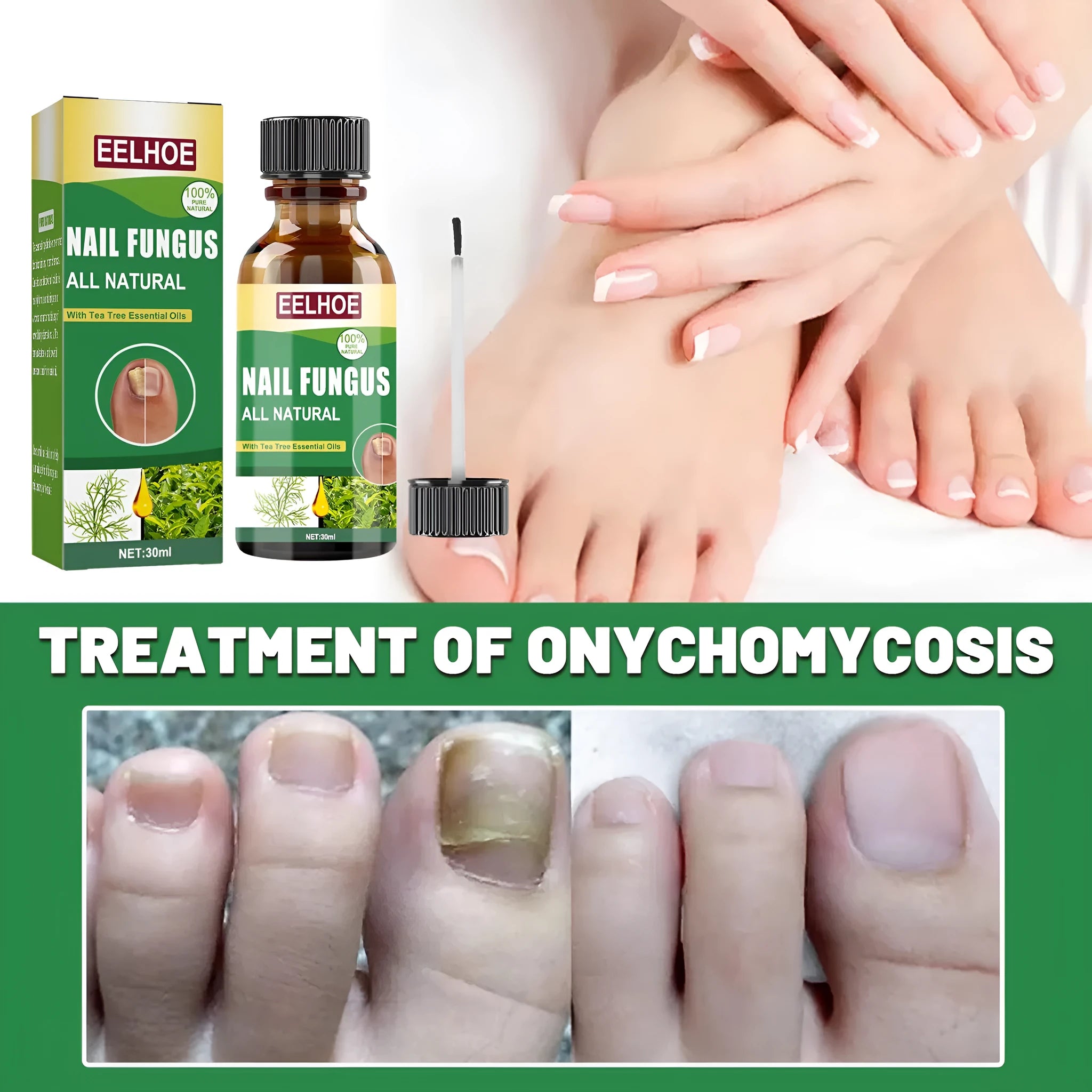 30ml bottle of tea tree oil nail repair liquid for thickened fingernails and toenails