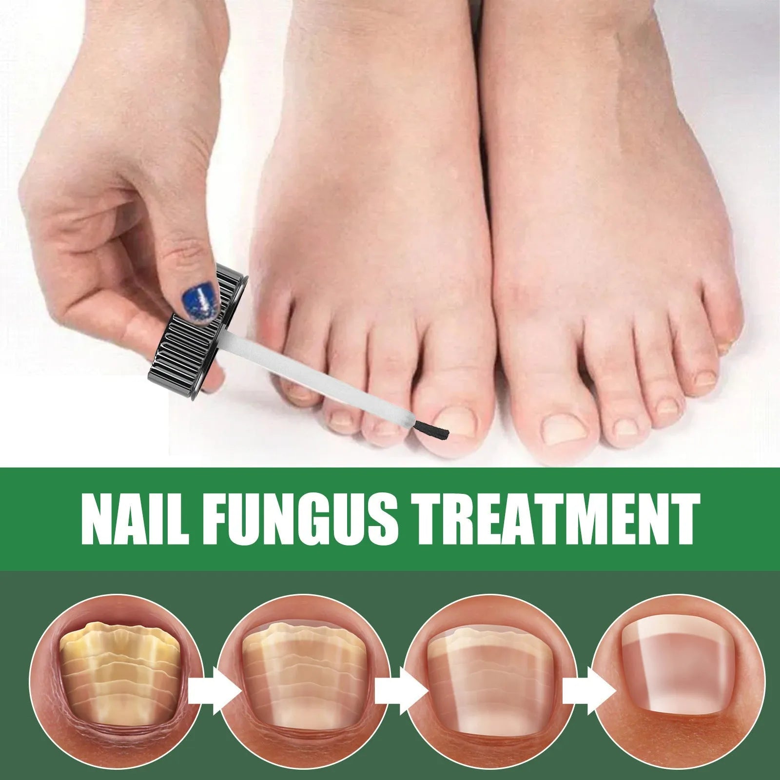 30ml bottle of tea tree oil nail repair liquid for thickened fingernails and toenails