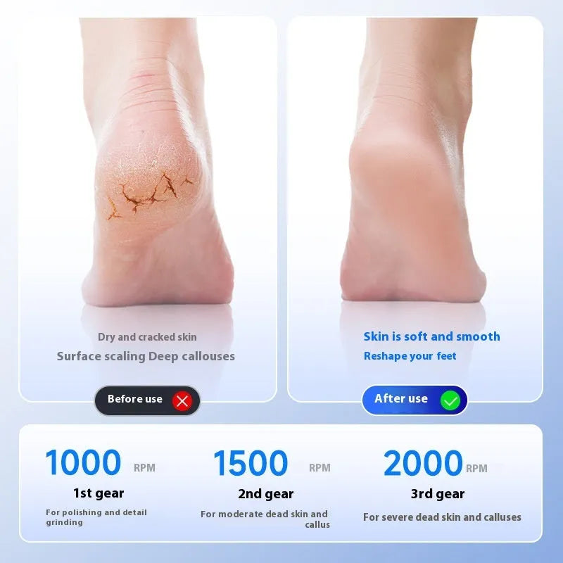 Fully automatic foot grinder exfoliating skin pedicure device with three-gear adjustment, 47x47x87mm, black colour