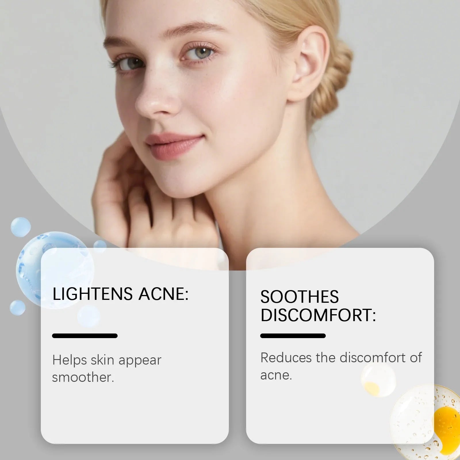 Pack of 80 breathable hydro-colloid acne patches for facial spot treatment
