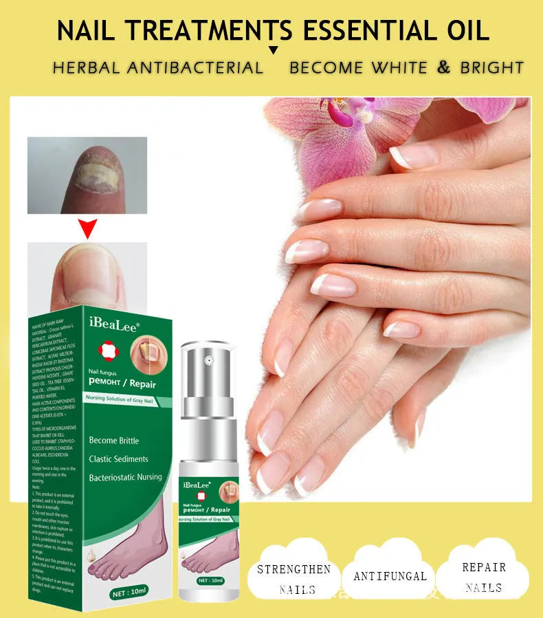 Jiagou Whitenail Antibacterial Liquid 10ml bottle for foot and toenail care
