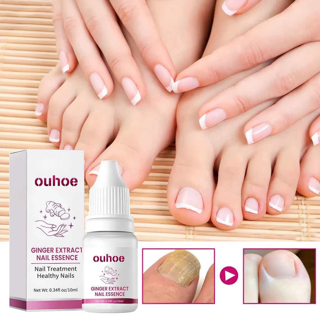 Ginger nail care essence 10ml bottle with dropper, showcasing clear liquid formula