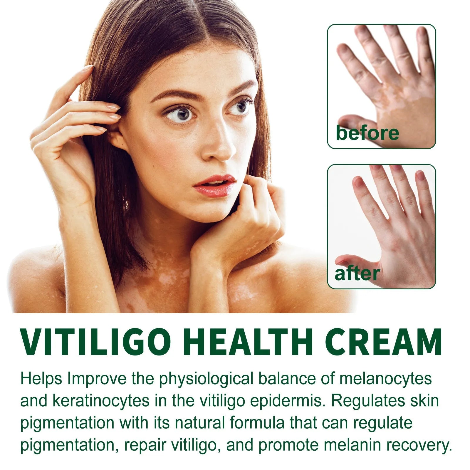 35g jar of body skin care cream for cleansing and moisturising to address orange peel skin texture