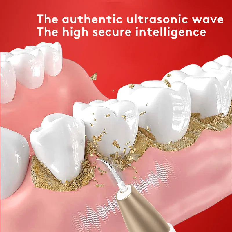 Gold ultrasonic tooth cleaning device for removing stains and tartar at home