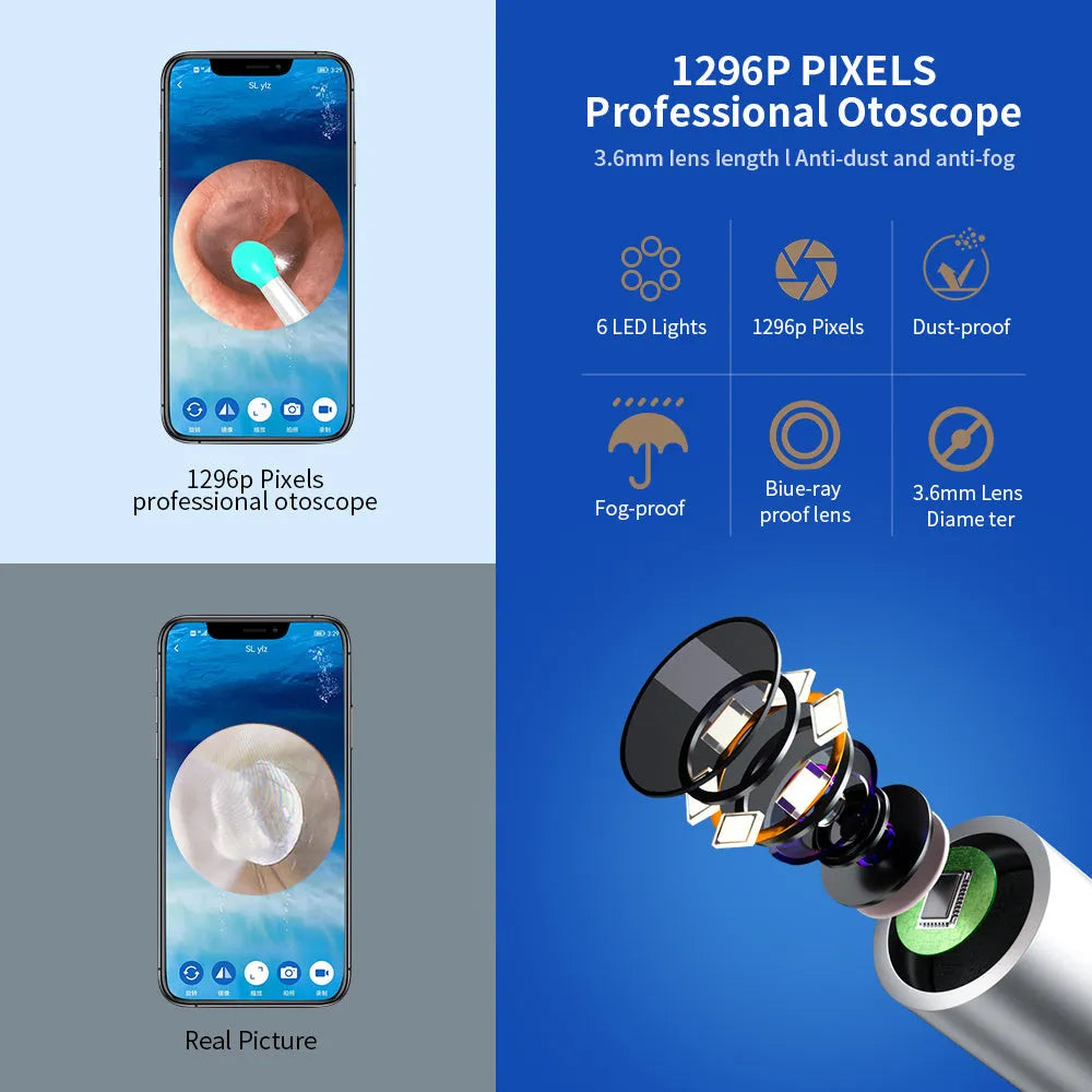 NE3 wireless ear otoscope ear wax removal tool with camera LED light and 360 HD lens